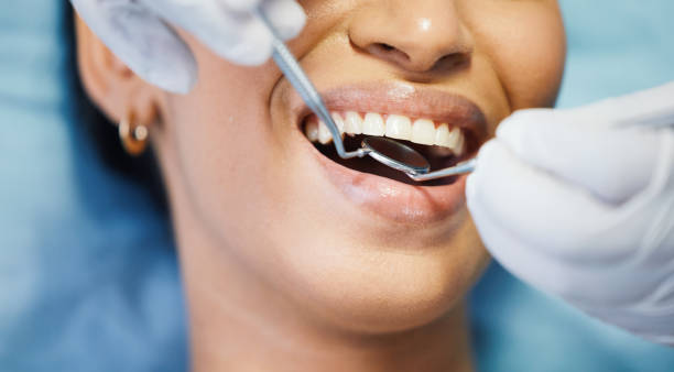 Best Emergency Broken Tooth Repair in Bamberg, SC